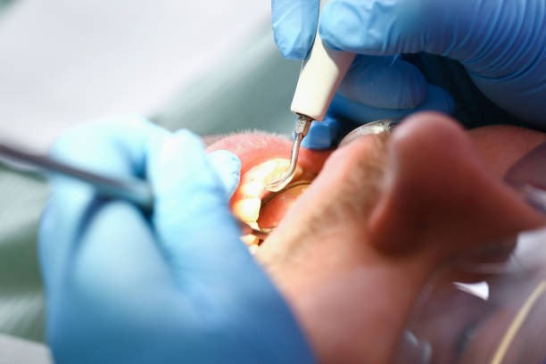 Best Emergency Tooth Extraction in Park View, IA