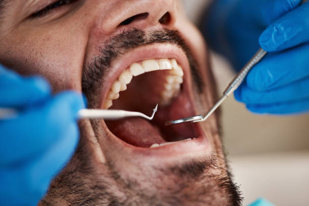 Best Emergency Tooth Extraction in Park View, IA