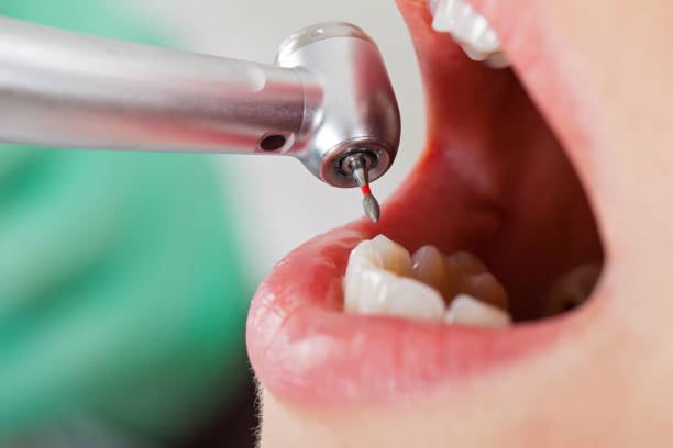 Best Emergency Root Canal Treatment in Park View, IA